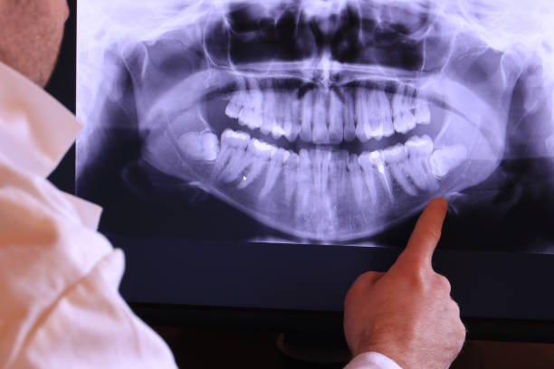 Best Emergency Treatment for Oral Infections in Burnt Store Marina, FL